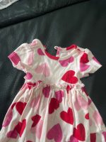 Bộ váy áo Valentine cho bé gái Carter’s, tặng kèm váy bodysuit màu hồng (Size: 0->3m) - Ảnh 7