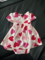 Bộ váy áo Valentine cho bé gái Carter’s, tặng kèm váy bodysuit màu hồng (Size: 0->3m) - Ảnh 2